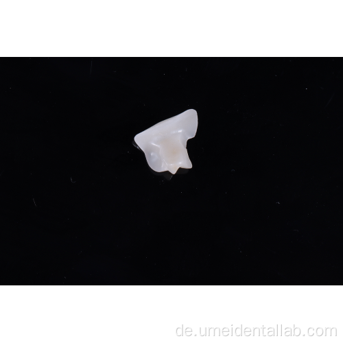 Zirkonia inlay